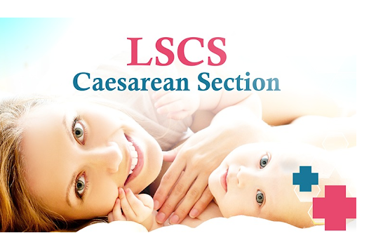 LSCS Caesarean Section Operation